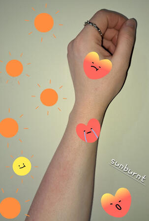 My first day back since Junior Nunhood for community work was a very hot day! I rolled up my sleeves to help cook and serve food outside. Later tonight I was itchy and the photo doesn't show how red it is but I have ended up sunburnt (*=_=)